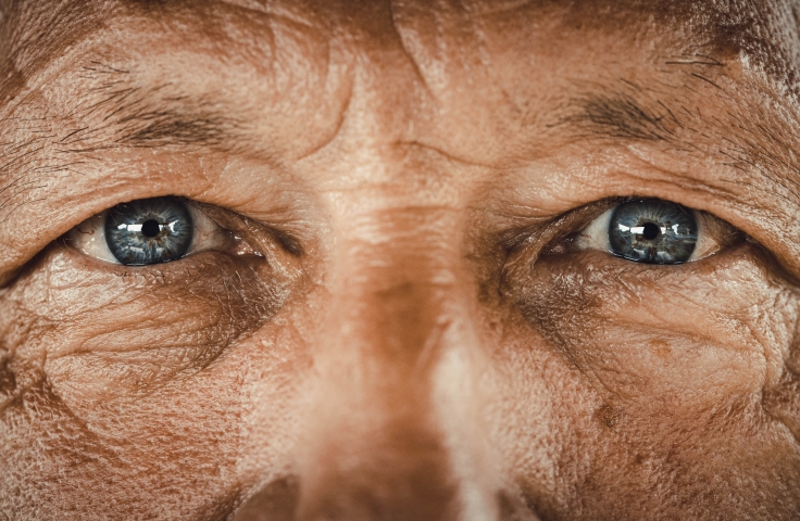 The eye as the window to the aging body 